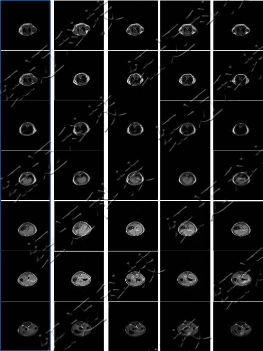 低场核磁共振技术在造影剂与动物成像中的应用